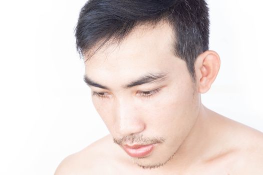 Young man serious hair loss problem for health care medical and shampoo product concept, selective focus