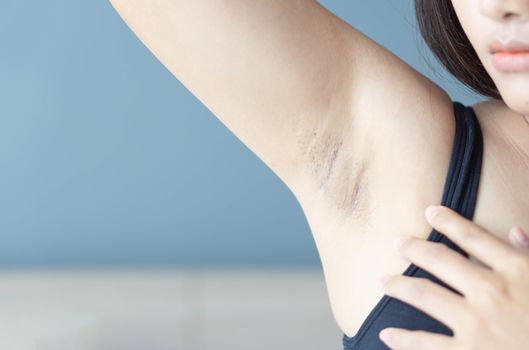 Women problem black armpit lying on white bed background for skin care and beauty concept, selective focus