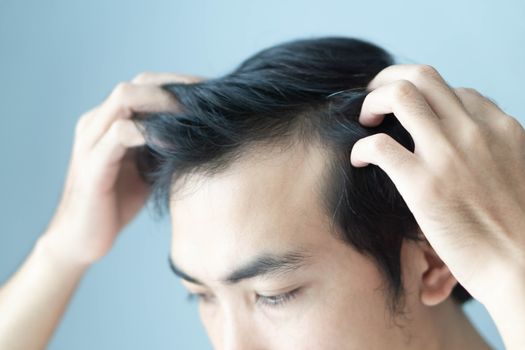 Young man serious hair loss problem for health care medical and shampoo product concept, selective focus