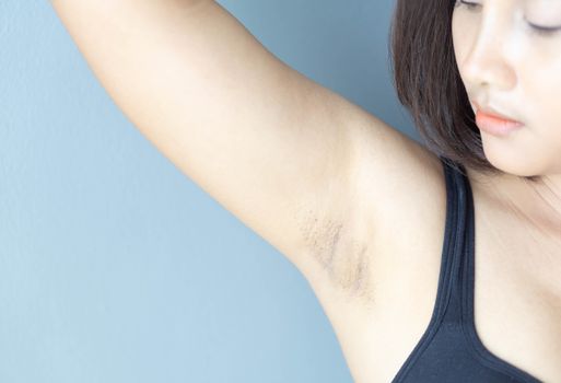 Women problem black armpit lying on white bed background for skin care and beauty concept, selective focus