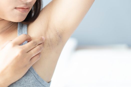 Women problem black armpit lying on white bed background for skin care and beauty concept, selective focus