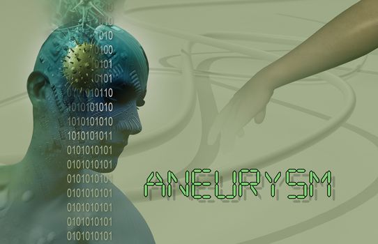 3d Medical illustration of brain aneurysm