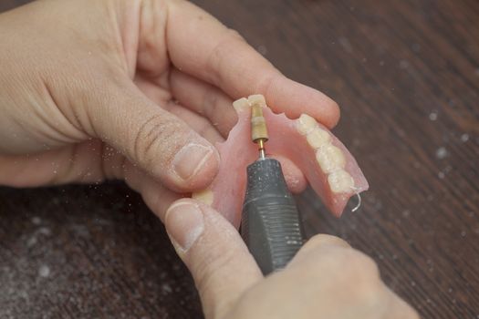 Dental technician with motor tool make denture prothesis in dental laboratory, close up