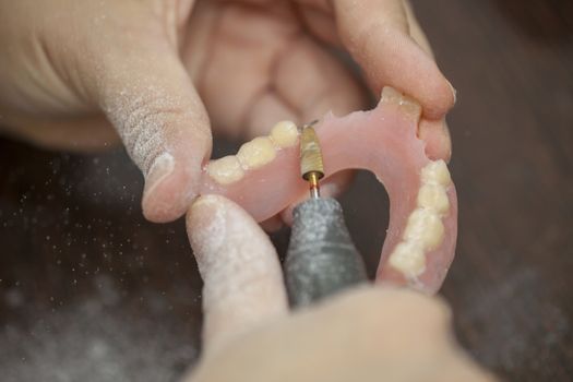 Hands of dental technician make denture prothesis in dental laboratory, close up
