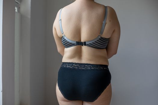 Woman Real Body Plus size Model in lingerie posignand showing fat back, imperfect nonideal