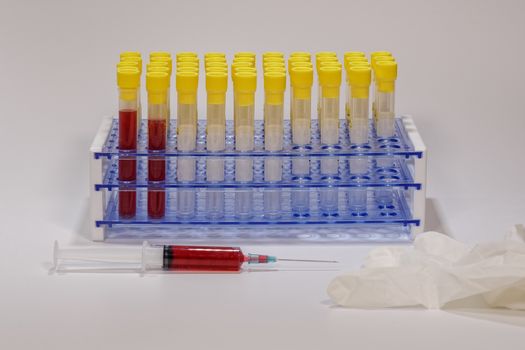 Clinical tests with laboratory testing medical equipment and a syringe with blood next to protective white glove.