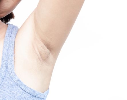 Women problem black armpit on white background for skin care and beauty concept