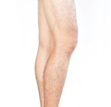 Closeup legs men skin and hairy for health care concept