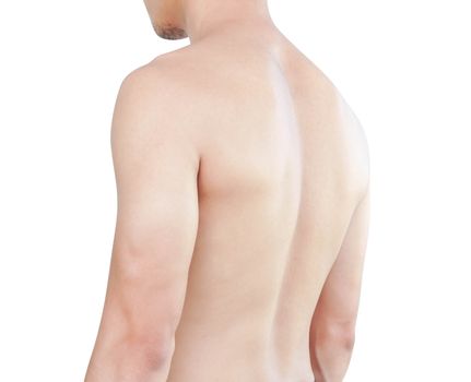 Side and back view of body asian man skin isolated with white background, health care and medical concept
