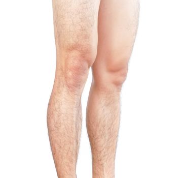 Closeup legs men skin and hairy for health care concept