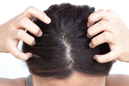 Closeup woman hand itchy scalp, Hair care concept