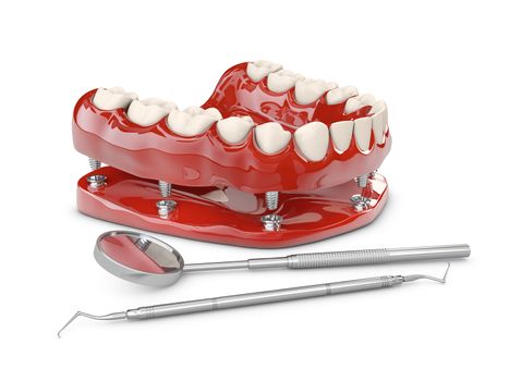 Human teeth and Dental implant. 3d illustration.