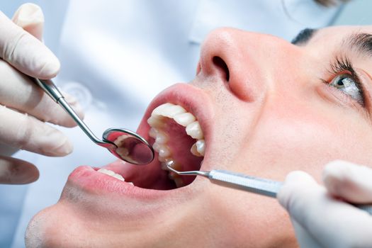 Extreme close up of Young man having dental checkup. Side view of open mouth with mouth mirror and dental hatchet.