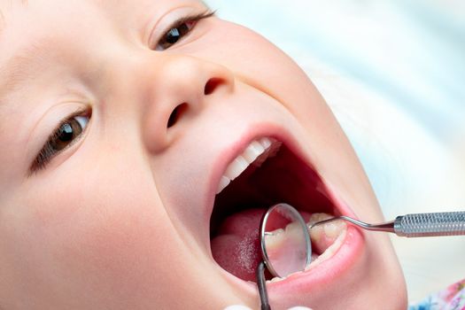Extreme close up of infant having dental examination. Hatchet and mouth mirror working on open mouth.