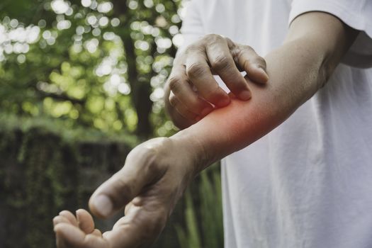 Man scratch itch with hand. Man scratching his hand healthcare concept.