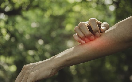 Man scratch itch with hand. Man scratching his hand healthcare concept.