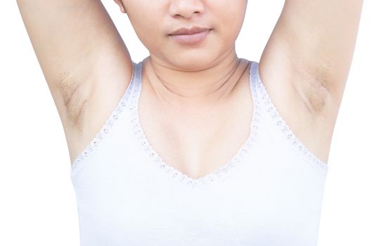 Women problem black armpit on white background for skin care and beauty concept