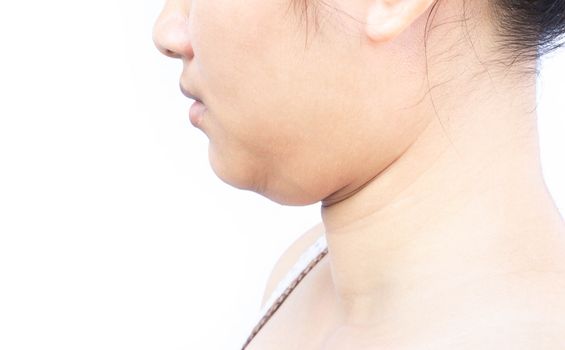 Closeup woman fat on second chin, health care and beauty concept