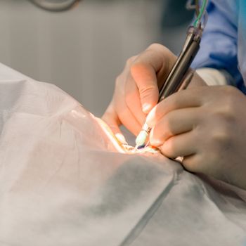 Doctors are in the process of conducting surgical operations on the eye. Closeup. medical concept