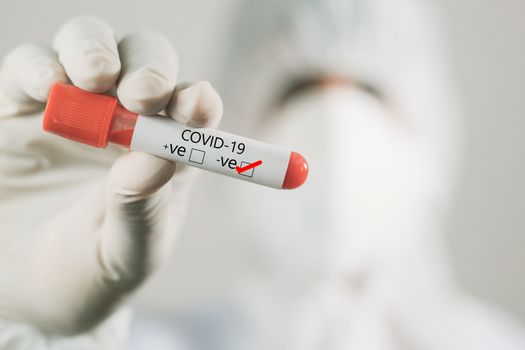 Doctor hand holding negative sample blood test tube of coronavirus, covid-19 or 2019-nCoV in laboratory