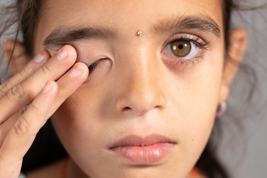 Extreme close up of child rubbing her eyes - concept showing to prevent and Avoid touching your eyes. Protect from COVID-19 or coronavirus infection or outbreak - Don t Touch Your eyes