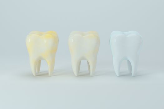 Changing of the tooth color from yellow to white, 3d rendering. Computer digital drawing.