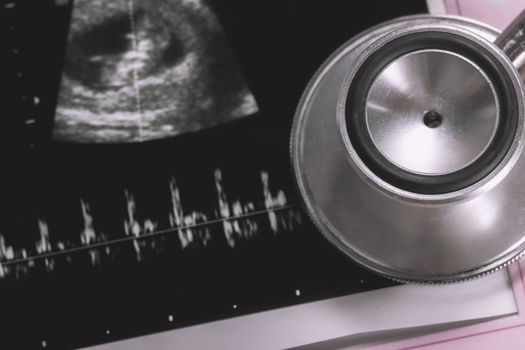 stethoscope and ultrasound scan picture of fetus
