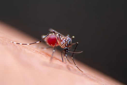 Striped mosquitoes are eating blood on human skin, Dangerous Malaria Infected Mosquito Skin Bite