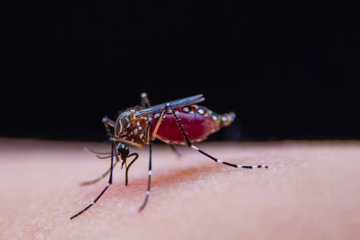 Striped mosquitoes are eating blood on human skin, Dangerous Malaria Infected Mosquito Skin Bite