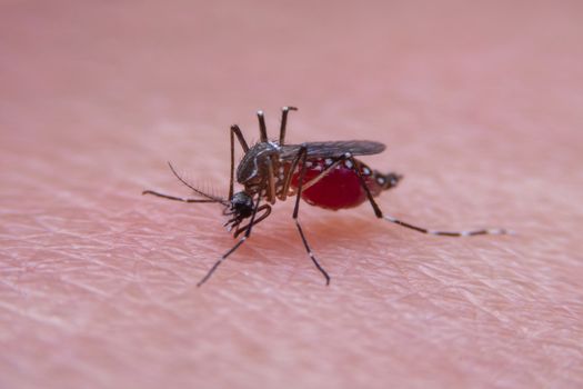 Striped mosquitoes are eating blood on human skin, Dangerous Malaria Infected Mosquito Skin Bite