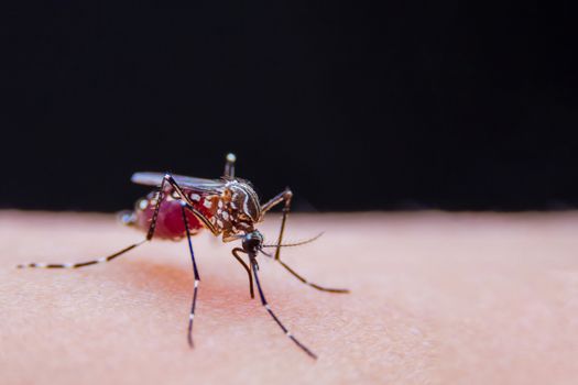 Striped mosquitoes are eating blood on human skin, Dangerous Malaria Infected Mosquito Skin Bite