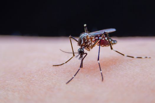 Striped mosquitoes are eating blood on human skin, Dangerous Malaria Infected Mosquito Skin Bite