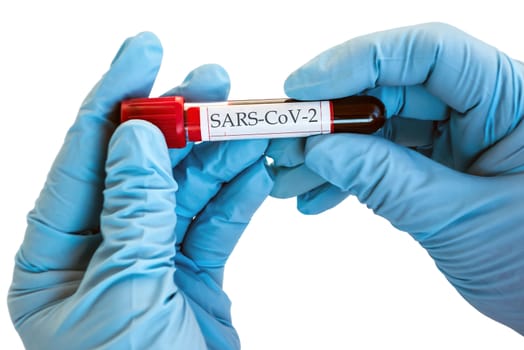 Pandemic Coronavirus 2019-nCoV Blood Sample Test Tube sample biochemical analysis Corona Virus in Lab.