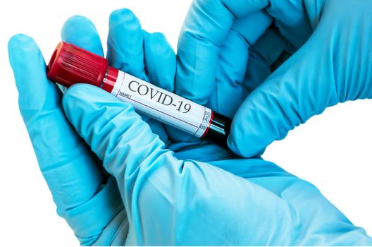 Pandemic Coronavirus 2019-nCoV Blood Sample Test Tube biochemical analysis