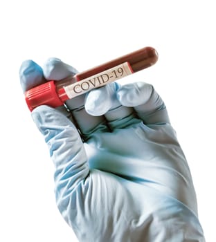 Blood Sample Test tube vaccine coronavirus SARS-CoV-2 biochemical analysis Corona Virus in Lab.
