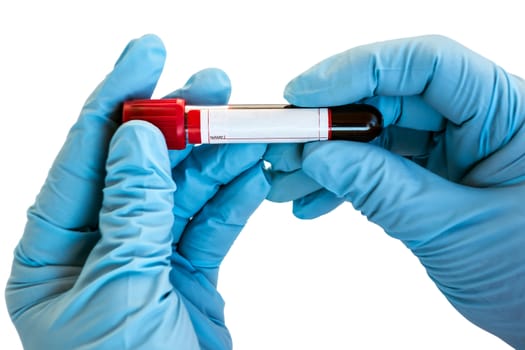 Test COVID-19 blood tube tested coronavirus Doctor Hand with blue glove isolated on white background