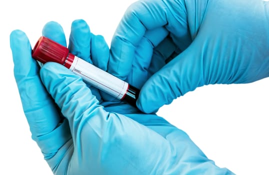 2019-nCoV Coronavirus Wuhan China Test Vacuum blood tube Doctor Hand with blue glove isolated on white background