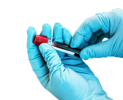 Test blood tube red tested positive for coronavirus Doctor Hand with blue glove isolated on white background