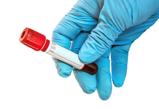 Test blood tube laboratory analysis Doctor Hand with blue glove isolated on white background