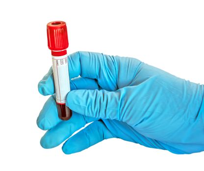 Test Vacuum blood tube red cap clot activator checkup samples in the lab for Covid-19 analyzing. Copy space test result label design. Doctor Hand with blue glove isolated on white background.