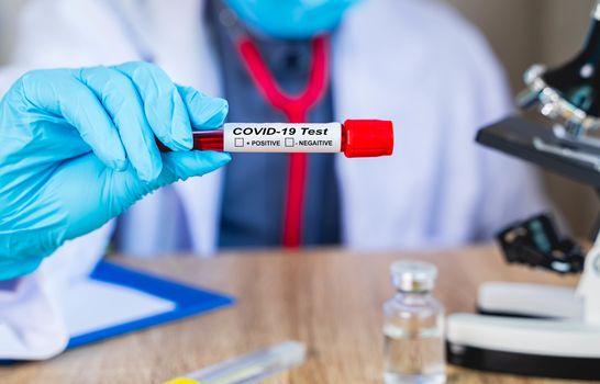 Close up The doctor's hand holds the patient's blood test results to find the Coronavirus or Covd-19 that is an outbreak in Epidemiology or infectious concept with blur background