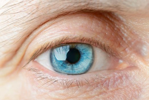 Macro of a hard contact lens on woman's blue eye