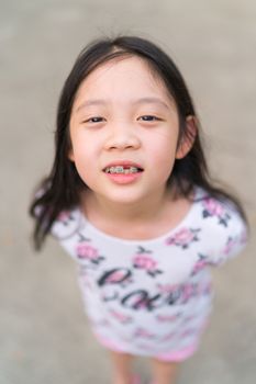 Smiling Asian kid with braces on teeth.