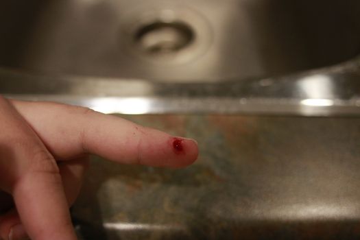 Bleeding blood from the cut finger wound. Injured finger with bleeding open cut wound. Closeup of finger human hand is cut hurt bleeding with bright red blood.