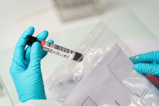 Coronavirus testing, a hand taking a tube of blood test samples of coronavirus (COVID-19) from transparent bag.