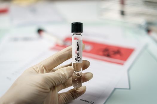 Scientist in laboratory with biological tube for analysis and sampling of Covid-19.