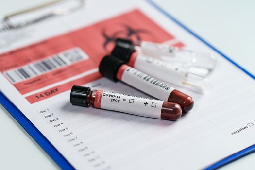 Blood test samples tube, reagent testing tube and swab collection kit in the laboratory, Coronavirus testing process. (Fake QR code and barcode)