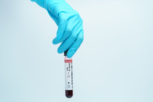 Hand with blue glove holding blood test tube samples of coronavirus (COVID-19).