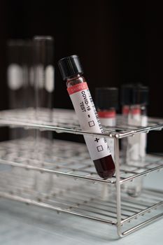 Coronavirus testing, a tube of blood test samples of coronavirus (COVID-19).