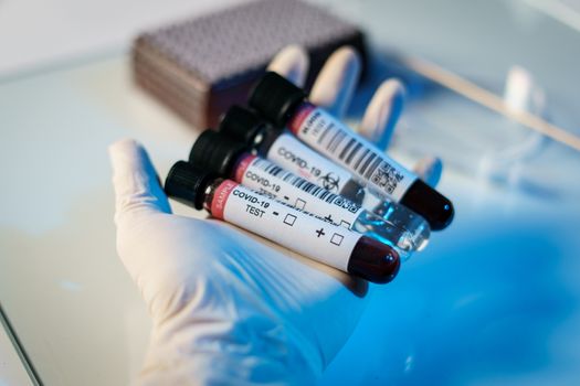Coronavirus testing process, a hand holds tube of blood test samples and swab collection kit specimen sample testing.